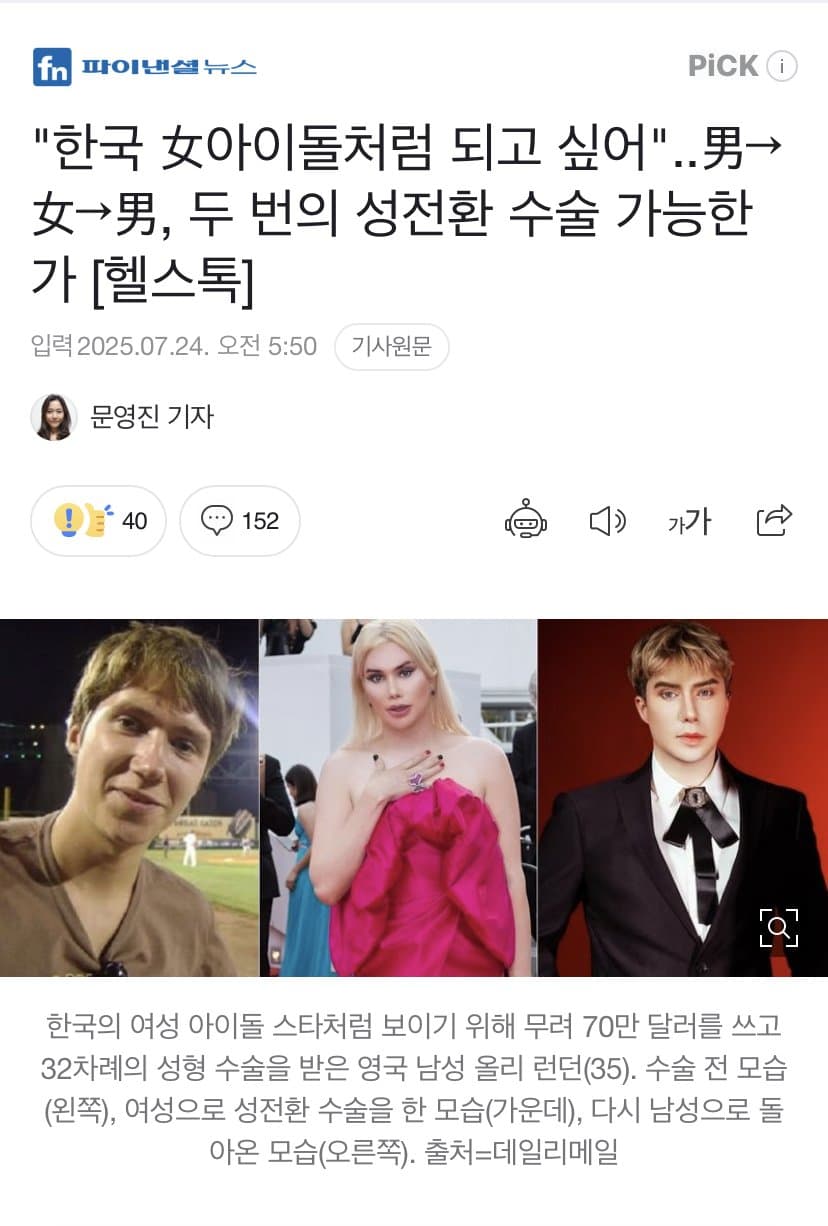 [이갤] 한국 여자아이돌처럼 되고 싶어 성전환 수술한 영국남자