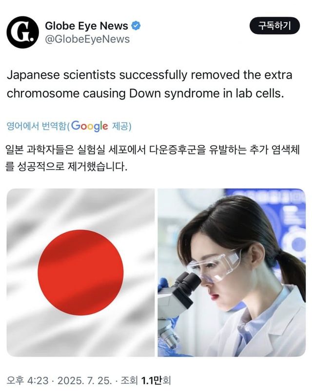 일본 다운증후군 유발 염색체 삭제 성공