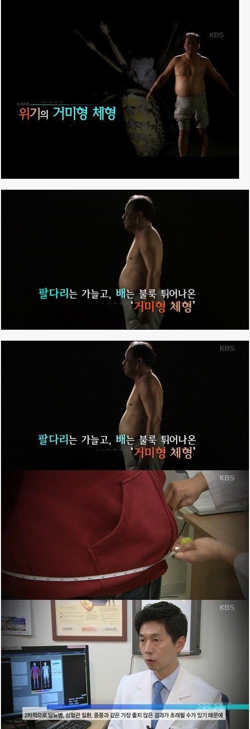 의사가 말하는 위험한 체형.