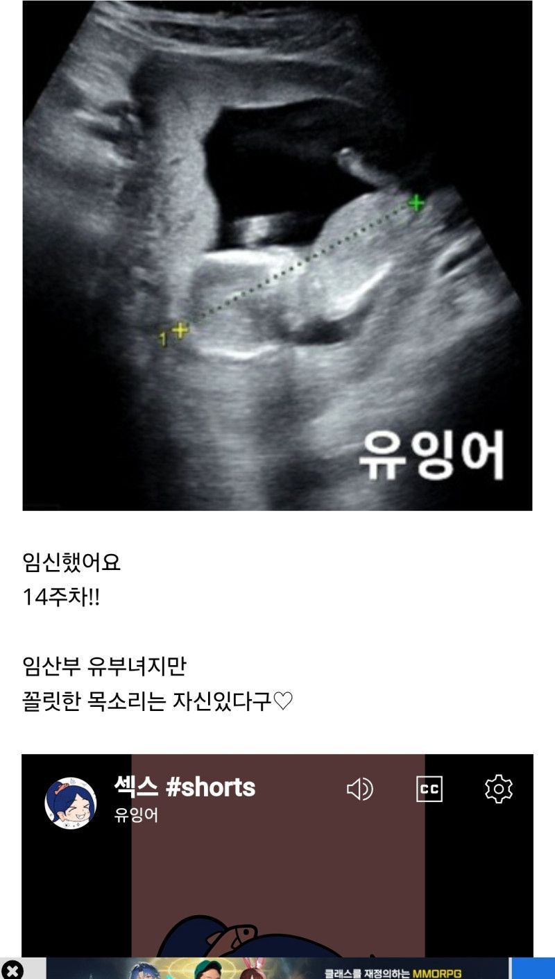 루리웹에 임신 인증한 과하게 개방적인 유튜버.jpg