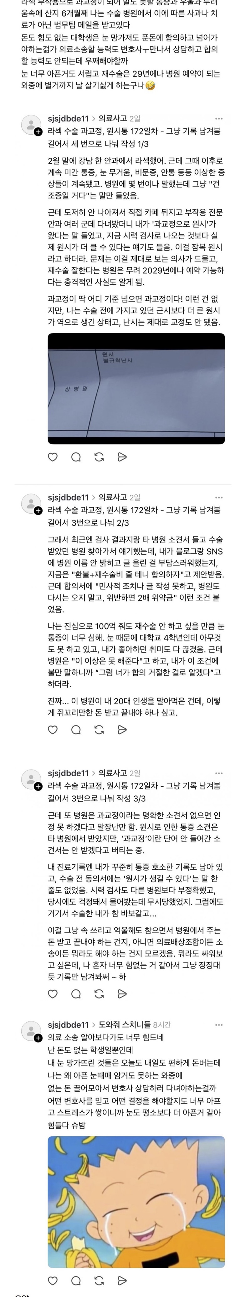 [이갤] 라섹 의료사고 당하고 고소 협박 당하는 대학생