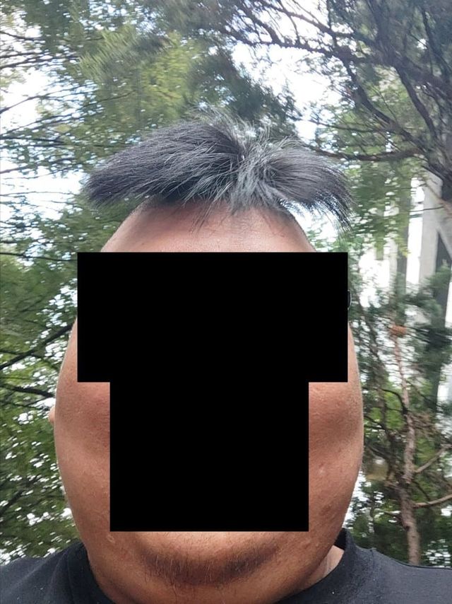 머리 개ㅅㅂ 어떡하냐